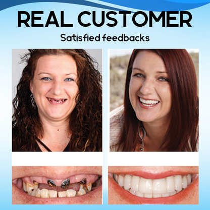 Bikenda™ Silicone Reline Denture Set